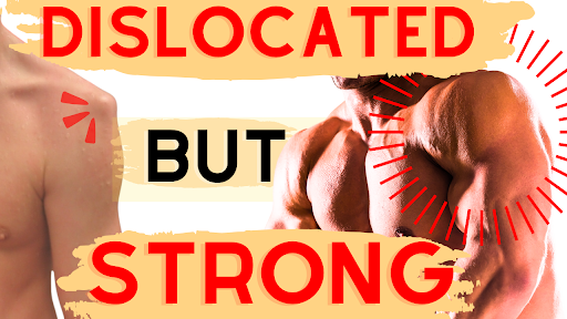 Shoulder Dislocation Level 3