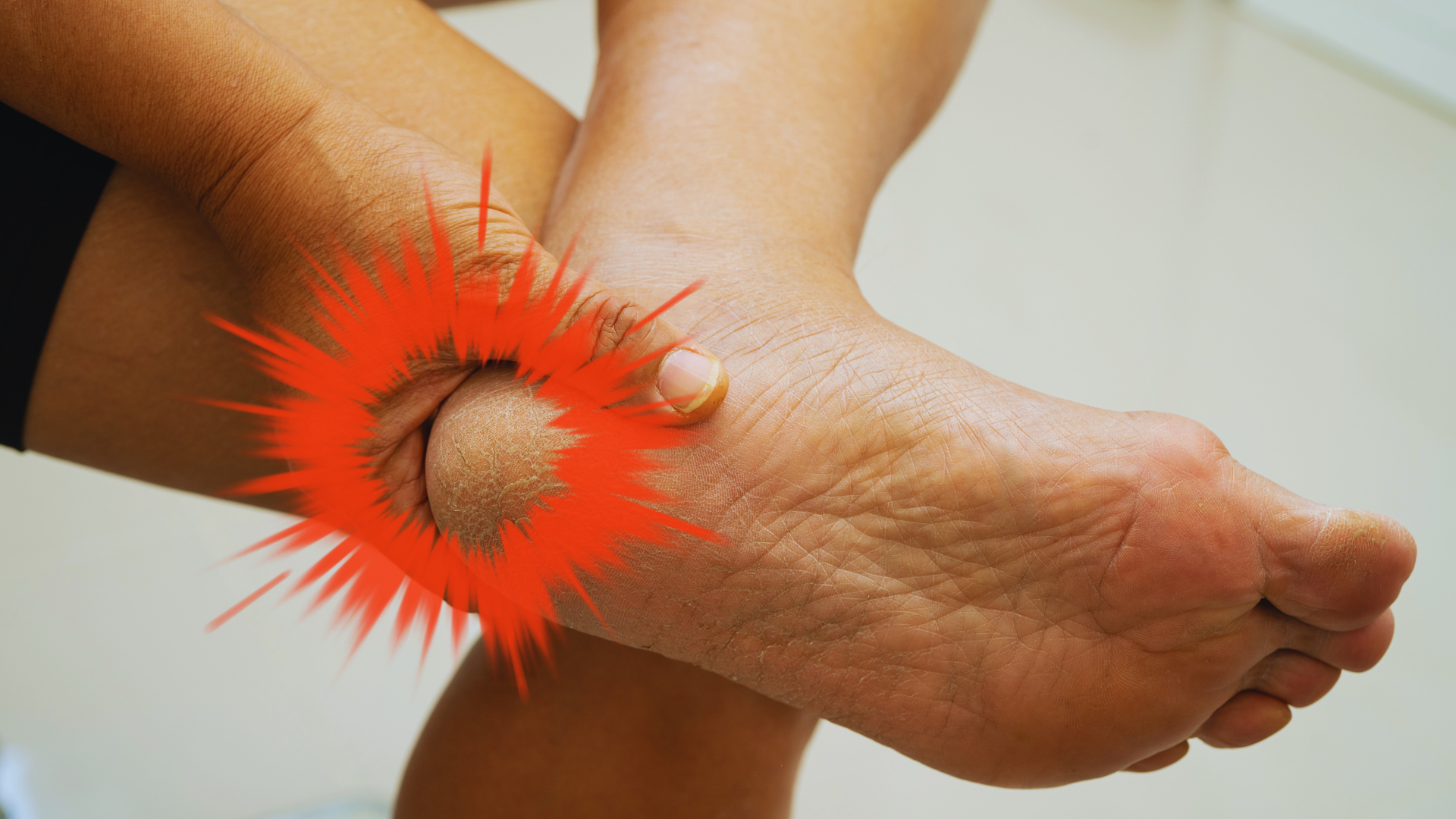 heel pain